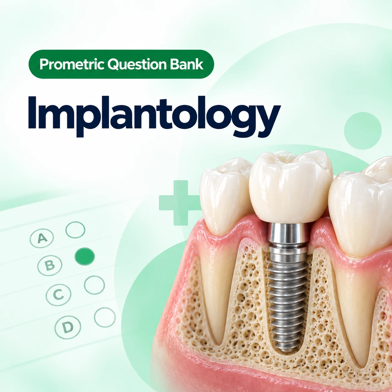 DOH Implantology Question Bank